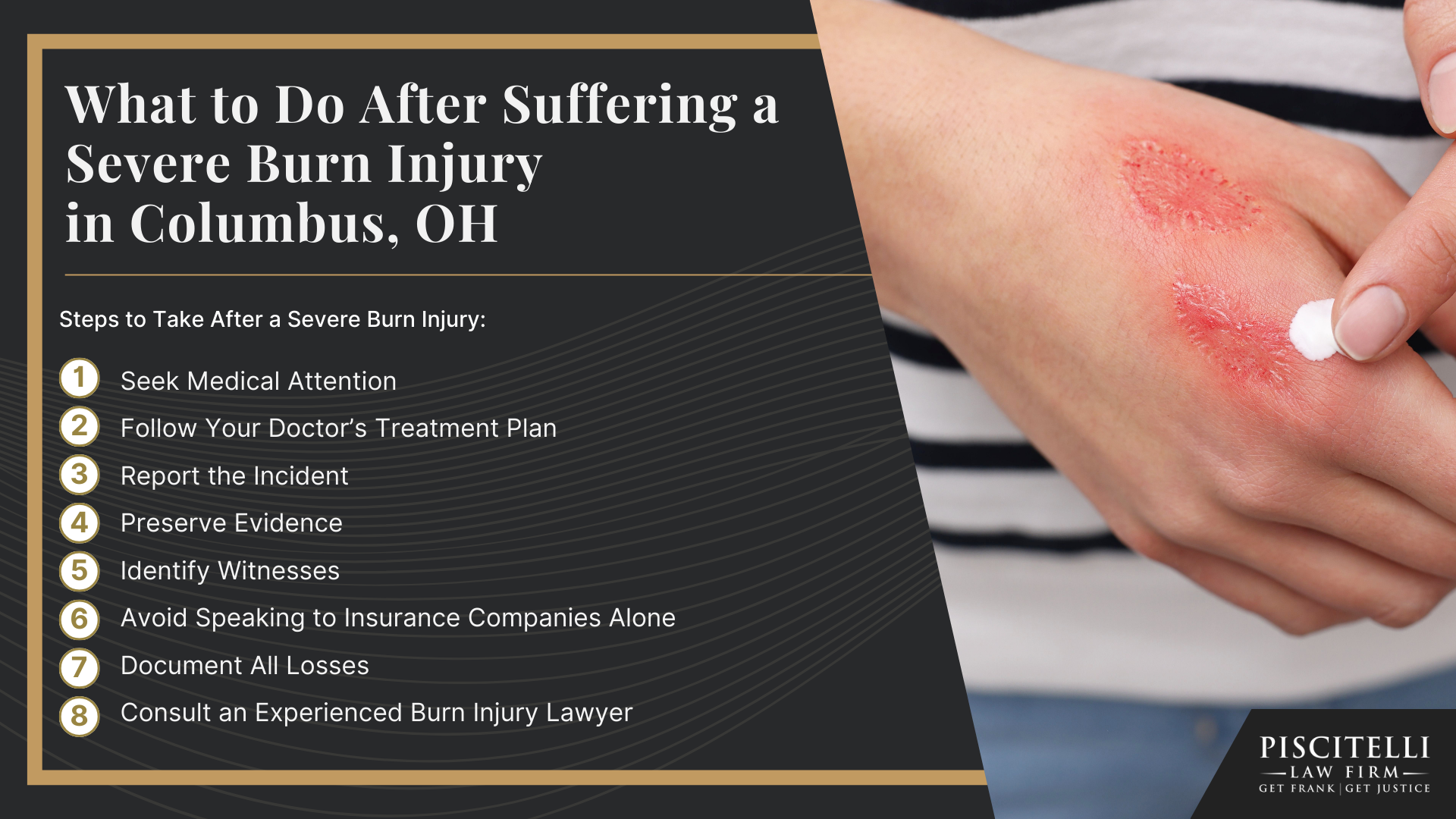 Meet Frank Piscitelli_ One of Columbus's Most Experienced Personal Injury Attorneys; What to Do After Suffering a Severe Burn Injury in Columbus, OH