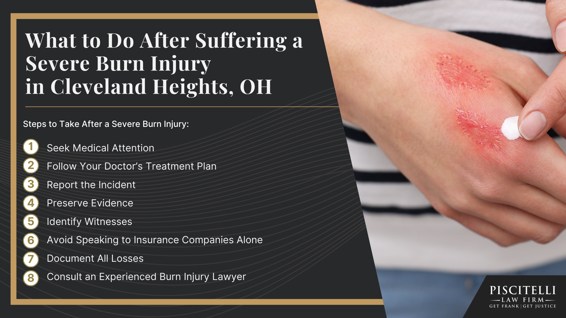Meet Frank Piscitelli_ One of Akron's Most Experienced Personal Injury Attorneys; What to Do After Suffering a Severe Burn Injury in Cleveland Heights, OH