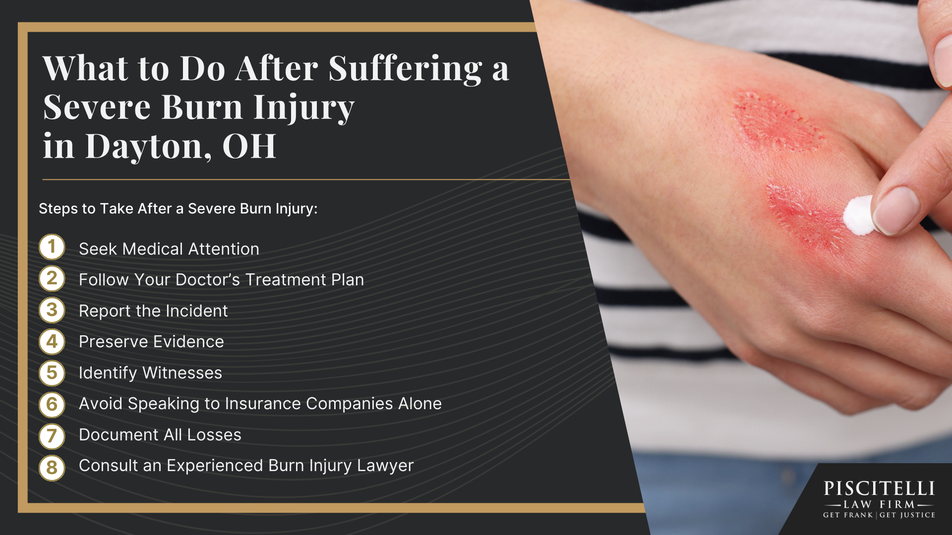 Meet Frank Piscitelli_ One of Dayton's Most Experienced Personal Injury Attorneys; What to Do After Suffering a Severe Burn Injury in Dayton, OH