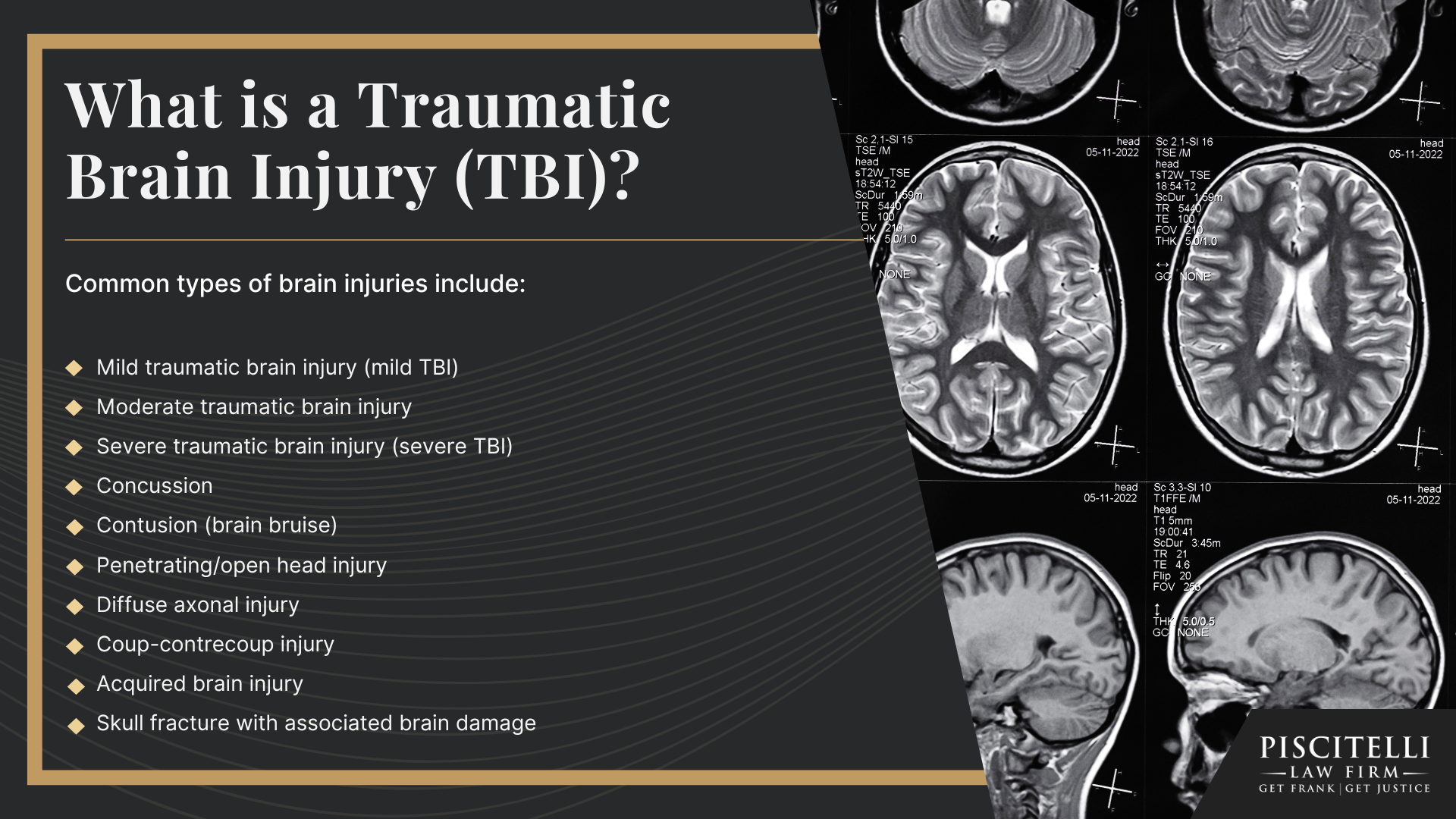 What is a Traumatic Brain Injury (TBI)