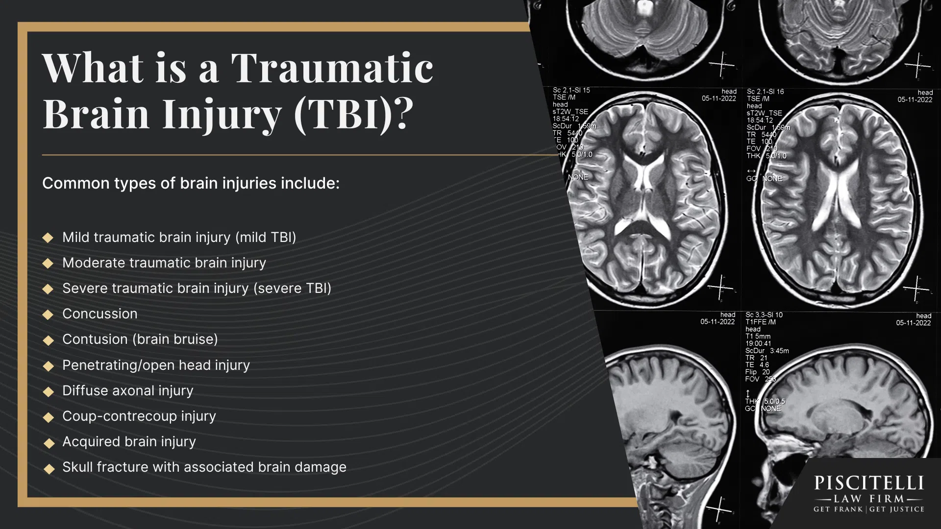 What is a Traumatic Brain Injury (TBI)