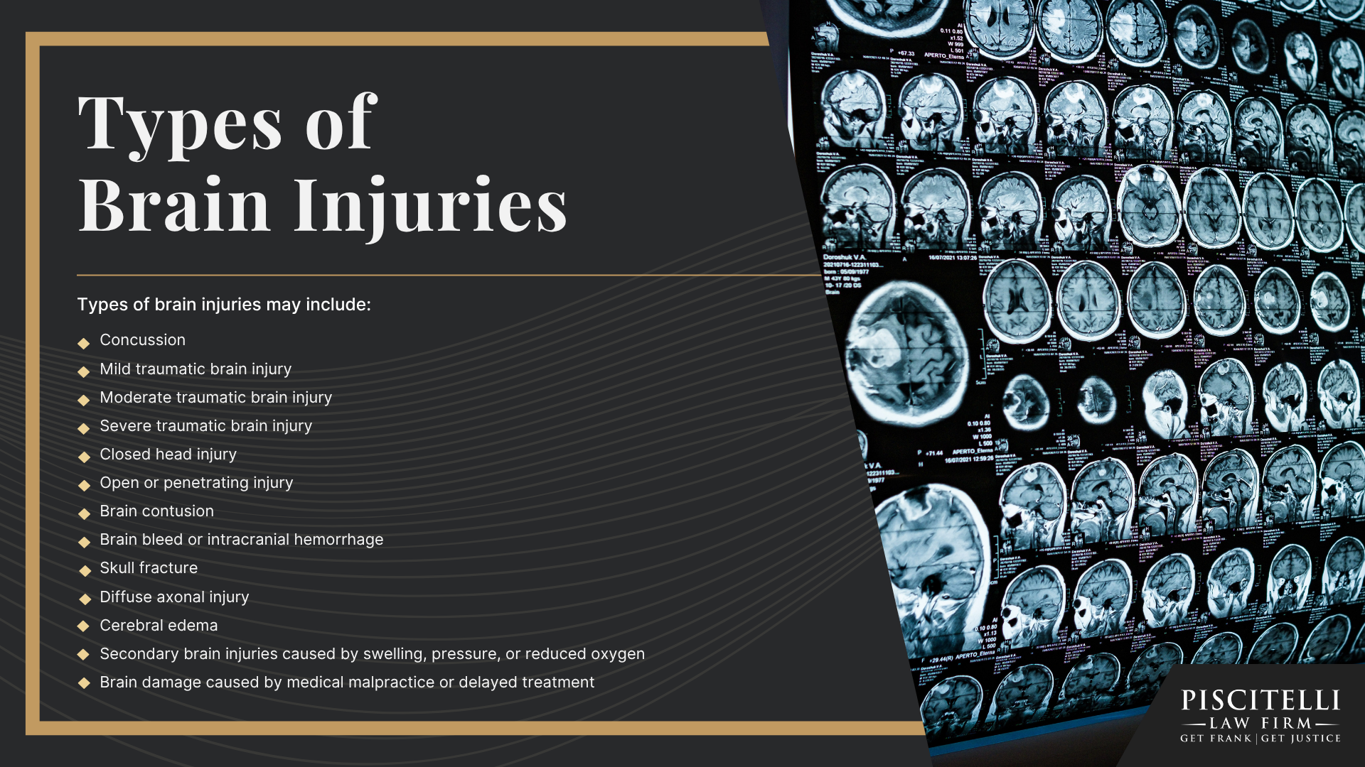 Why Brain Injury Claims Require Specialized Medical and Legal Evidence;  Common Accidents That Cause Brain Injuries in Mentor; What Is a Traumatic Brain Injury; Types of Brain Injuries