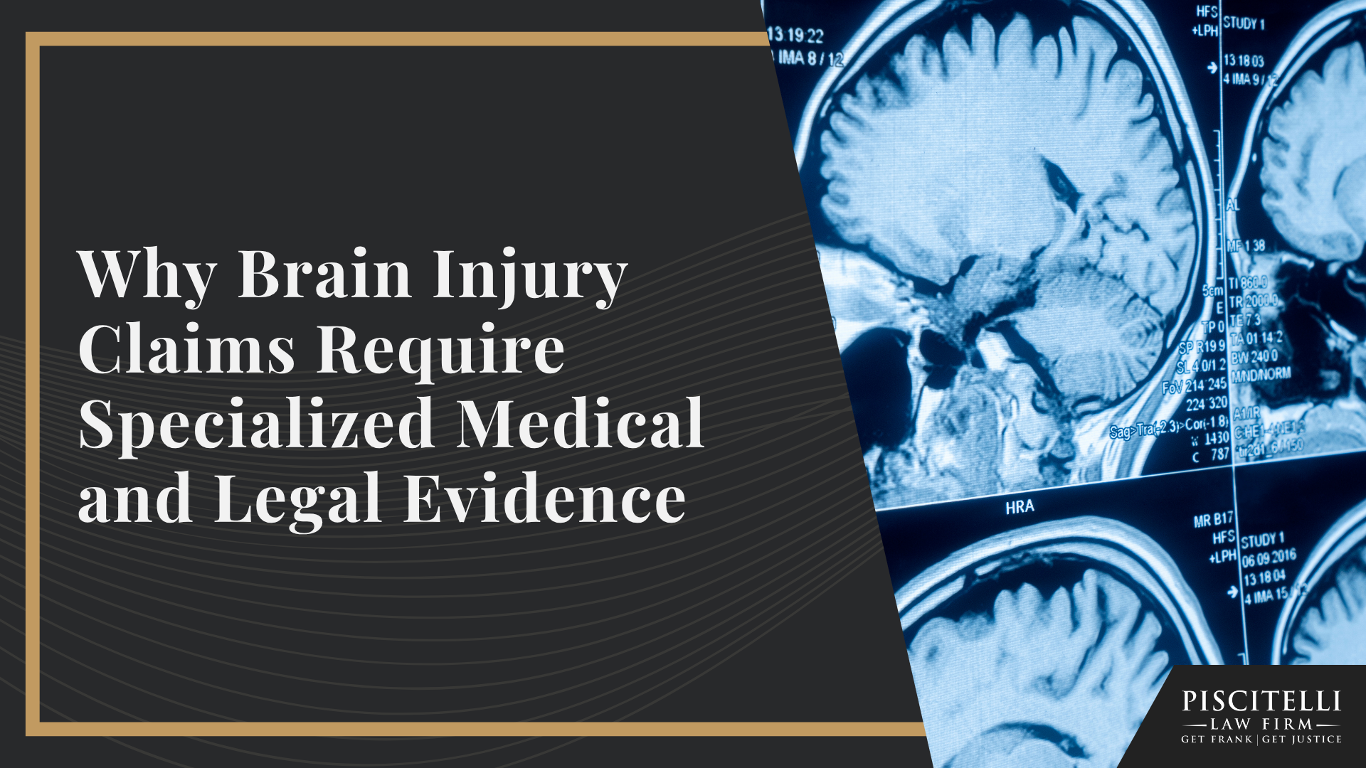 Why Brain Injury Claims Require Specialized Medical and Legal Evidence